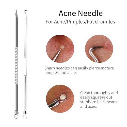 GERY Blackhead Remover Pimple Popper Tool – Leather Carrying Case: The set comes in a stylish and compact leather – Image 4