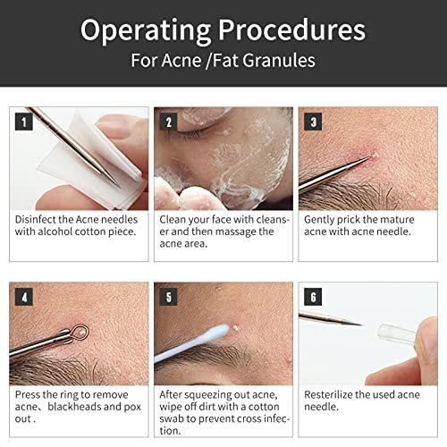 GERY Blackhead Remover Pimple Popper Tool – Ergonomic Design: Each tool features a comfortable grip for easy – Image 14