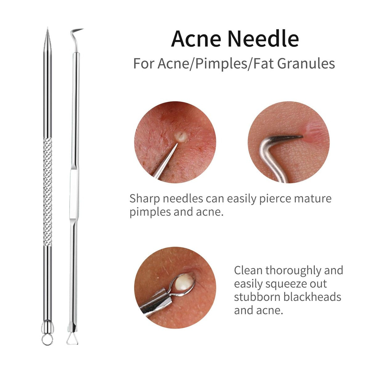 GERY Blackhead Remover Pimple Popper Tool – Ergonomic Design: Each tool features a comfortable grip for easy – Image 3