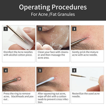 GERY Blackhead Remover Pimple Popper Tool – Premium Stainless Steel: The tools are made from high-quality metal – Image 13