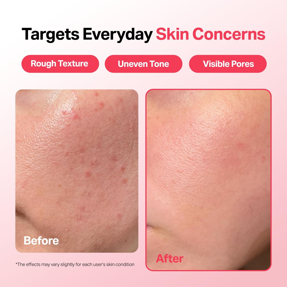Meebak Camellia Clear Daily Exfoliating Serum – 2% Niacinamide + AHA & PHA, Gentle Chemical Exfoliant for Smooth Texture & Balanced Tone, Hydrating Pore Minimizer, Korean Skincare (1.01 Fl Oz) - görsel 6