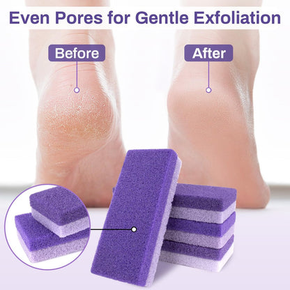 RAQEHO 10 Pumice Stone for Feet - Double Sided Purple Foot File for Callus Removal, Hard Skin Exfoliating, Pedicure Scrubber (Pack of 10)