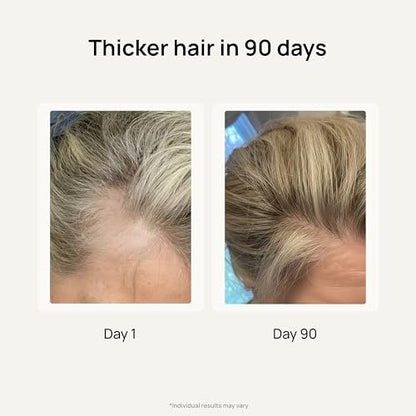 Lunos Grow Hair Growth Supplements - 17 Ingredient Hair Vitamins with Biotin, Saw Palmetto & Marine Collagen - 1 Month Supply Avelisse