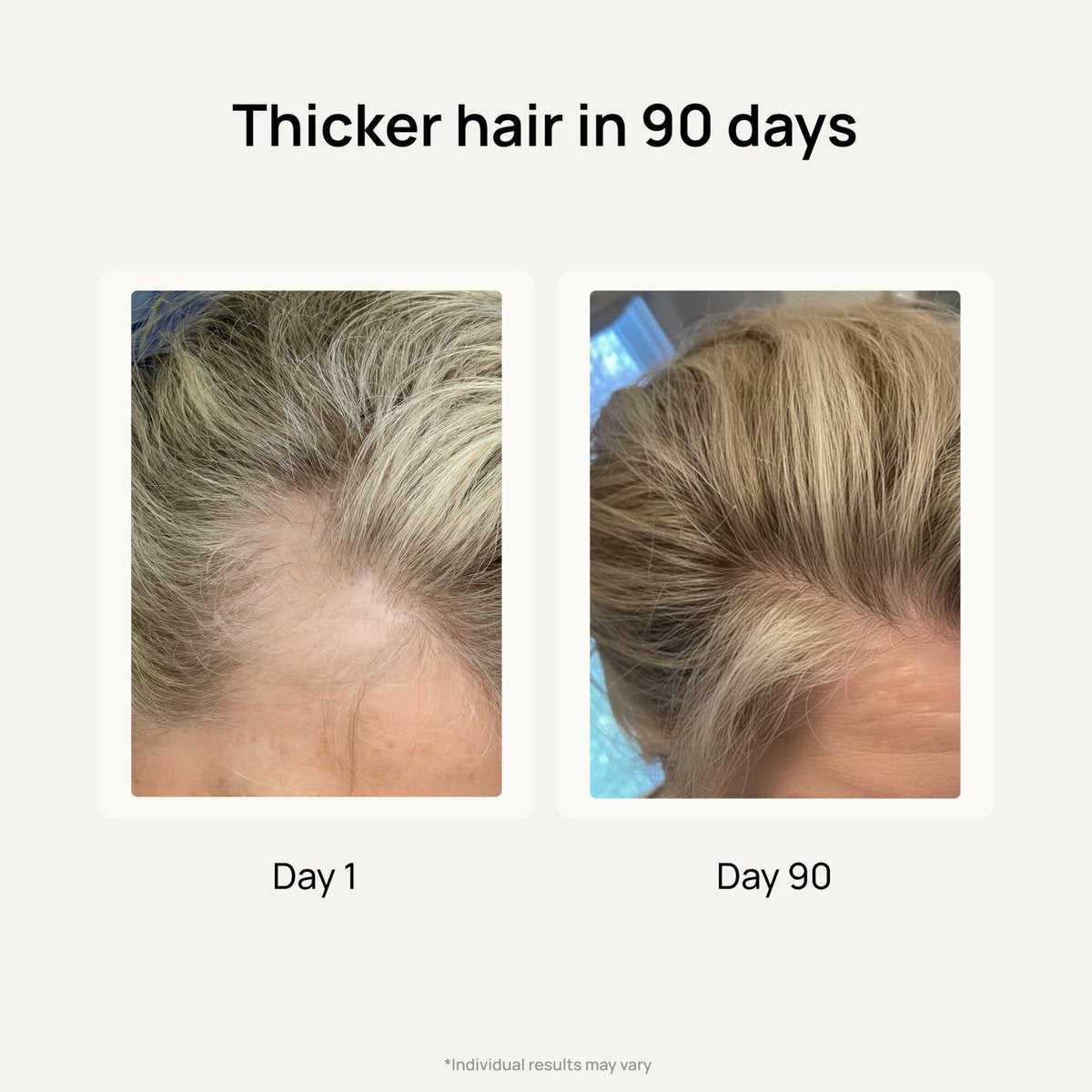 Lunos Grow Hair Growth Supplements - 17 Ingredient Hair Vitamins with Biotin, Saw Palmetto & Marine Collagen - 1 Month Supply Avelisse