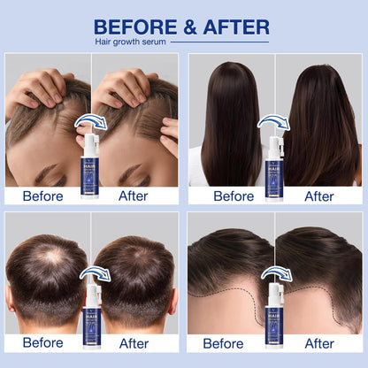 VENANOCI Hair Growth Oil Spray - Natural Hair Regrowth Serum with Rosemary & Biotin for Thicker, Fuller Hair | Anti-Hair Loss Treatment for Women and Men Avelisse