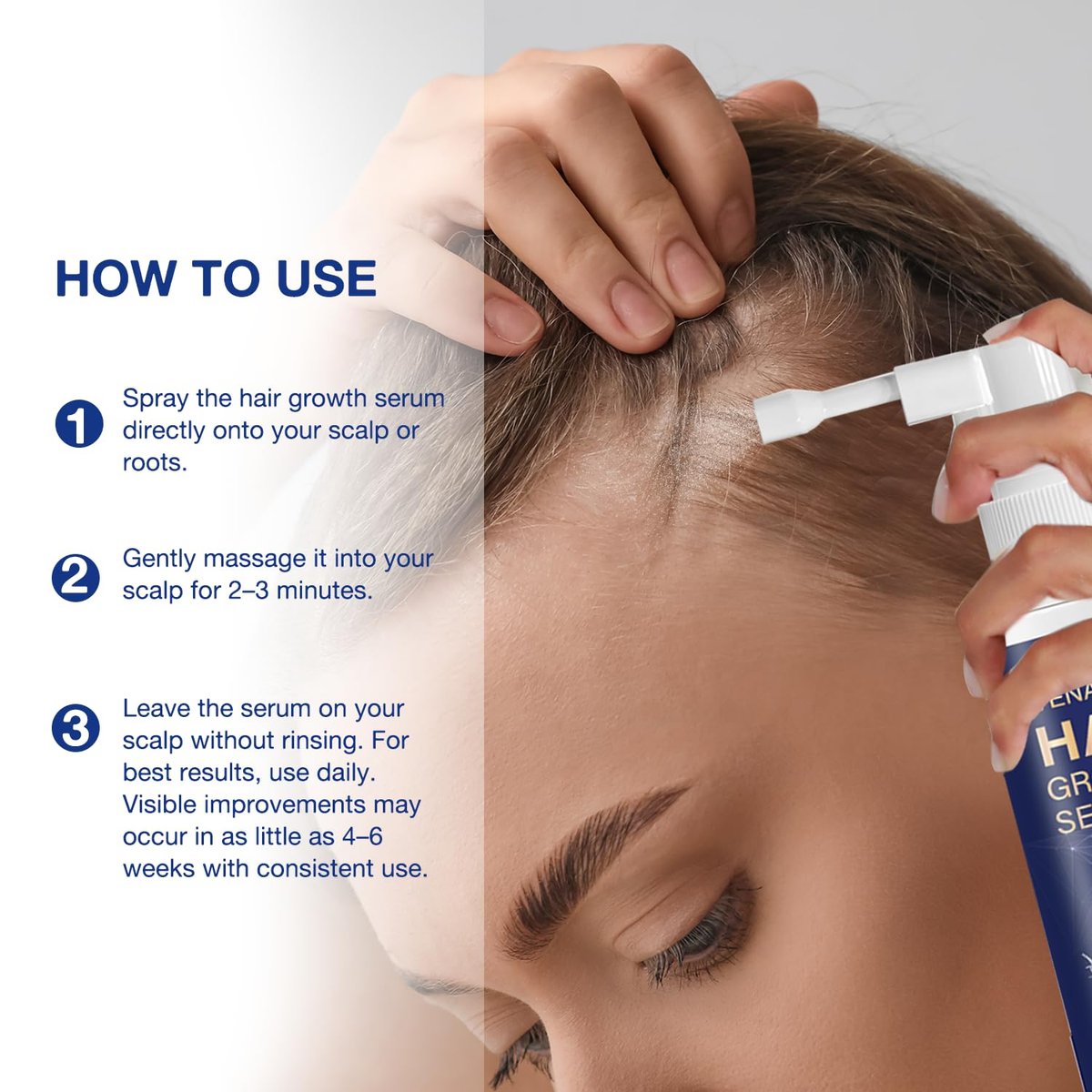 VENANOCI Hair Growth Oil Spray - Natural Hair Regrowth Serum with Rosemary & Biotin for Thicker, Fuller Hair | Anti-Hair Loss Treatment for Women and Men Avelisse