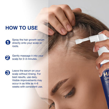 VENANOCI Hair Growth Oil Spray - Natural Hair Regrowth Serum with Rosemary & Biotin for Thicker, Fuller Hair | Anti-Hair Loss Treatment for Women and Men Avelisse
