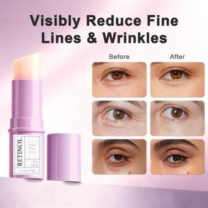 Retinol Eye Stick with Hyaluronic Acid & Collagen - Under Eye Cream for Dark Circles, Puffiness and Wrinkles, Anti-Aging Formula, 0.35 oz