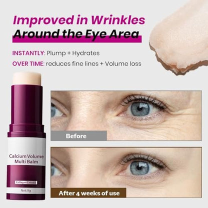 KOEC Calcium Volume Eye Patch 60pcs with Volume Multi Balm - Deep Hydration & Firming Eye, Face & Neck Care Avelisse