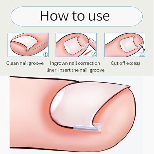 CHEMAILON Professional Ingrown Toenail Toolkit - Breathable Strips, Curved Corrector Patch, Painless File & Lifter for Home Pedicure Care (16 Count) - görsel 10