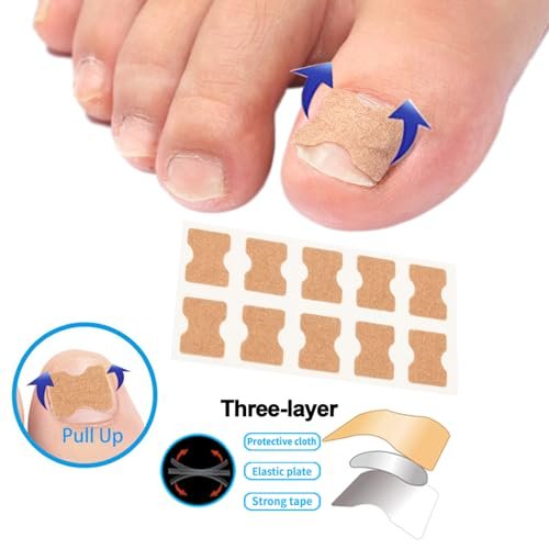 CHEMAILON Professional Ingrown Toenail Toolkit - Breathable Strips, Curved Corrector Patch, Painless File & Lifter for Home Pedicure Care (16 Count) - görsel 4