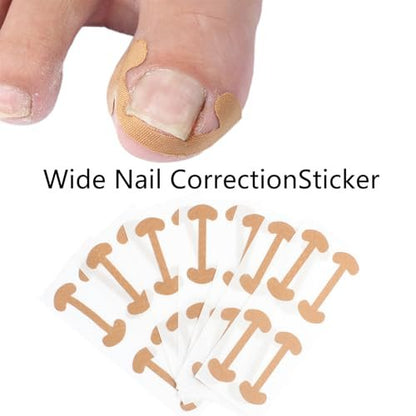 CHEMAILON Professional Ingrown Toenail Toolkit - Breathable Strips, Curved Corrector Patch, Painless File & Lifter for Home Pedicure Care (16 Count)