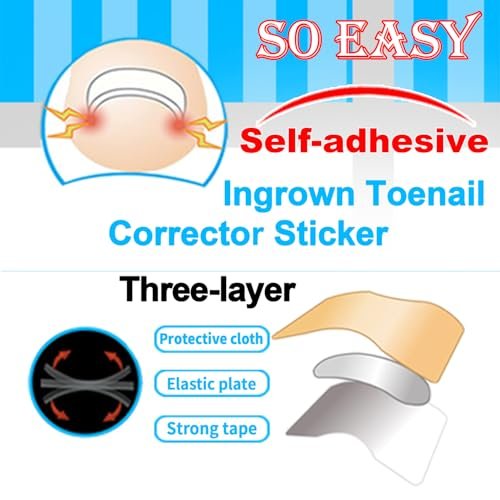 CHEMAILON Professional Ingrown Toenail Toolkit - Breathable Strips, Curved Corrector Patch, Painless File & Lifter for Home Pedicure Care (16 Count) - görsel 6