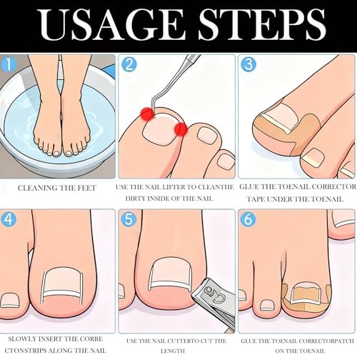 CHEMAILON Professional Ingrown Toenail Toolkit - Breathable Strips, Curved Corrector Patch, Painless File & Lifter for Home Pedicure Care (16 Count) - görsel 16