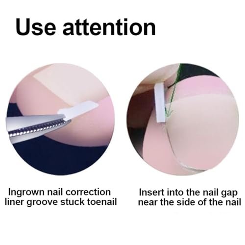 CHEMAILON Professional Ingrown Toenail Toolkit - Breathable Strips, Curved Corrector Patch, Painless File & Lifter for Home Pedicure Care (16 Count) - görsel 8