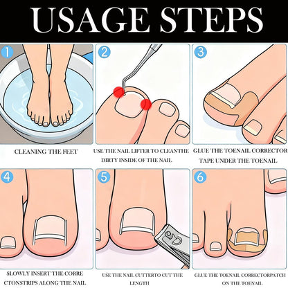 CHEMAILON Professional Ingrown Toenail Toolkit - Breathable Strips, Curved Corrector Patch, Painless File & Lifter for Home Pedicure Care (16 Count)