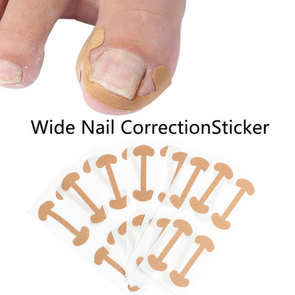 CHEMAILON Professional Ingrown Toenail Toolkit - Breathable Strips, Curved Corrector Patch, Painless File & Lifter for Home Pedicure Care (16 Count)