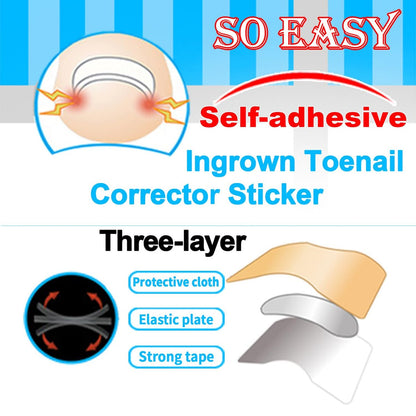 CHEMAILON Professional Ingrown Toenail Toolkit - Breathable Strips, Curved Corrector Patch, Painless File & Lifter for Home Pedicure Care (16 Count)