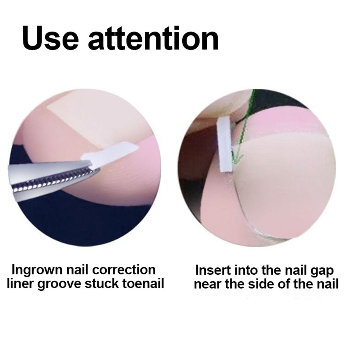 CHEMAILON Professional Ingrown Toenail Toolkit - Breathable Strips, Curved Corrector Patch, Painless File & Lifter for Home Pedicure Care (16 Count) - görsel 7