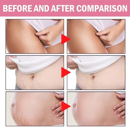 JINMAO Adeus Crema Brasileña – Intensive Multifunctional Body Treatment with Arnica, Ginger, Caffeine & Green Tea for Smooth, Elastic Skin – 300g Avelisse