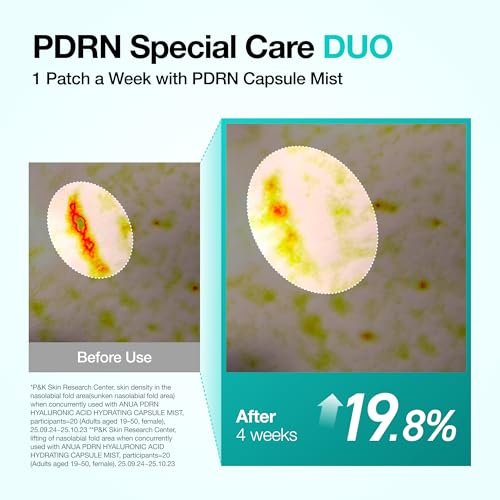 Anua Salmon DNA PDRN Collagen Melting Patch for Glass Skin - Smile Line & Wrinkle Patches, Firming Fine Lines, Hydrating, Korean Skincare, 2 Pairs x 4EA Avelisse