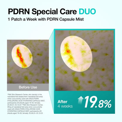 Anua Salmon DNA PDRN Collagen Melting Patch for Glass Skin - Smile Line & Wrinkle Patches, Firming Fine Lines, Hydrating, Korean Skincare, 2 Pairs x 4EA Avelisse