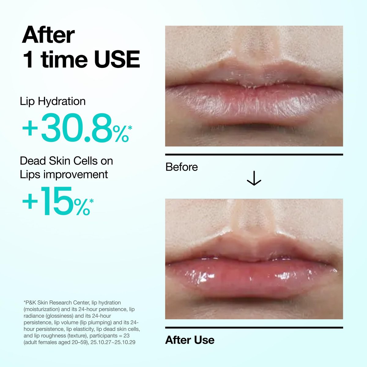 Anua PDRN Lip Serum – Long-Lasting Hydration for Dry, Cracked Lips with Salmon DNA, Hyaluronic Acid & Collagen | Korean Skincare | 0.33 fl.oz Avelisse