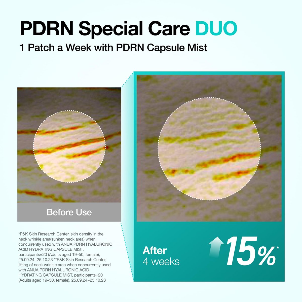 Anua PDRN Collagen Melting Patch for Neck – Lifting & Firming Thin Film Patches with Salmon DNA, Korean Skincare, 4 Patches Avelisse