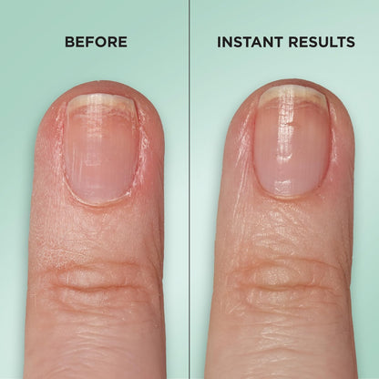 Sally Hansen Gel Rehab Nail Treatment Pen - Repair, Hydrate & Renew Damaged Nails with Keratin & Vitamin Complex, Mess-Free On-the-Go Nail Care