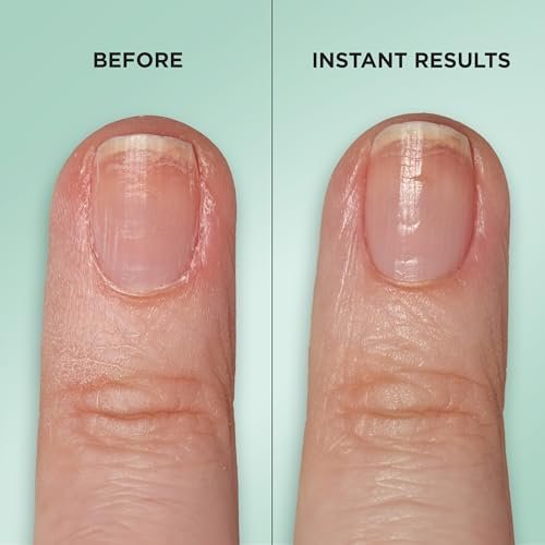 Sally Hansen Gel Rehab Nail Treatment Pen - Repair, Hydrate & Renew Damaged Nails with Keratin & Vitamin Complex, Mess-Free On-the-Go Nail Care - görsel 6
