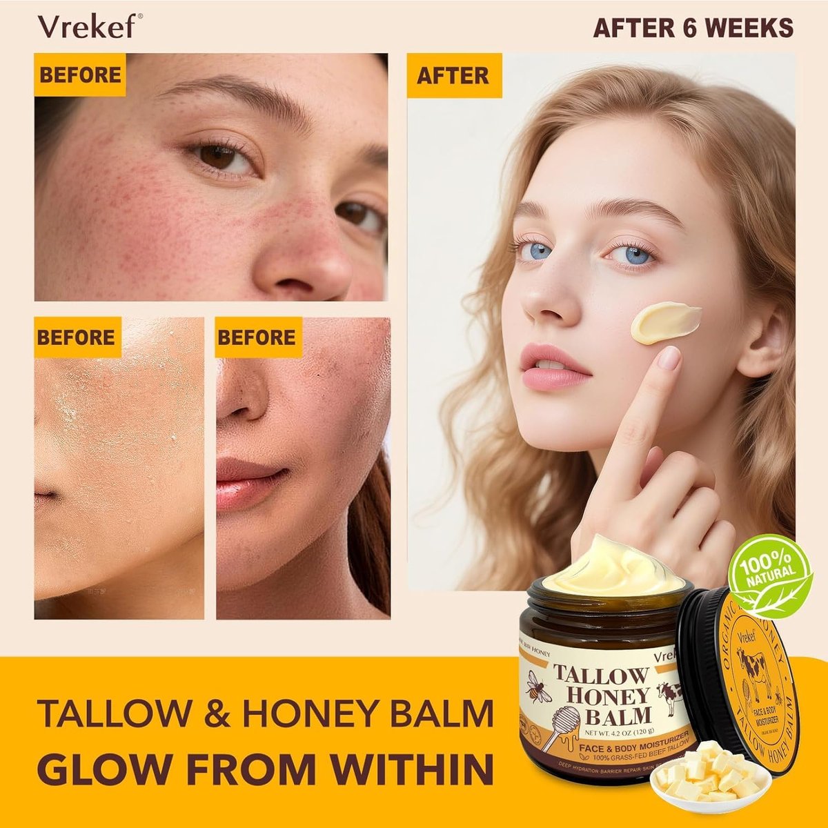 VREKEF Beef Tallow for Skin (4.2 oz) – Tallow and Honey Balm for Face & Body – Grass-Fed Tallow with Beeswax, Sea Buckthorn Oil, Shea Butter, Vitamin E – Natural Moisturizer Avelisse