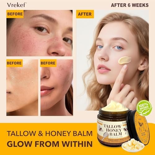 VREKEF Beef Tallow for Skin (4.2 oz) – Tallow and Honey Balm for Face & Body – Grass-Fed Tallow with Beeswax, Sea Buckthorn Oil, Shea Butter, Vitamin E – Natural Moisturizer Avelisse