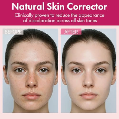 Roseblem Arbutin 7% + Tranexamic Acid 4% Face Cream for Dark Spots & Uneven Skin Tone – Hydrating, Non-Irritating, Safe for Sensitive Skin, 1.76 oz (Pack of 2) Avelisse