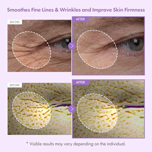 TOSOWOONG Bakuchiol Capsule Cream - High Purity Bakuchiol 5,000ppm Retinol Alternative Wrinkle Care Firming Anti Aging Moisturizer with 12 Peptides & 3 Ceramides - Korean Skincare 50ml Avelisse