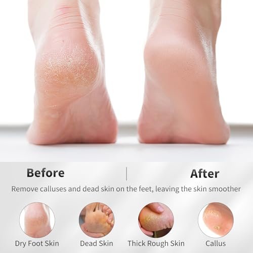 ÖkoStamm 4 Pack Natural Volcanic Pumice Stone for Feet – Rough Feet Scrubber with Hanging Rope for Dead Skin Removal, Pedicure Exfoliation Tool for Feet, Elbows, Knees - görsel 8