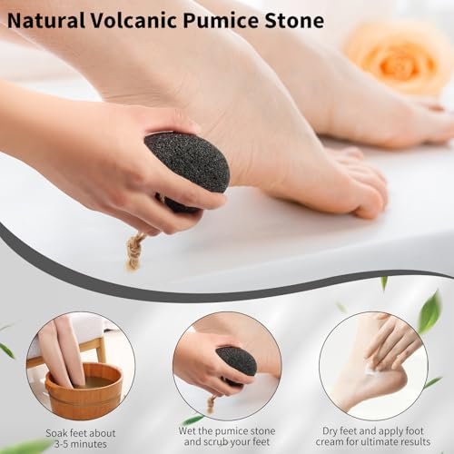 ÖkoStamm 4 Pack Natural Volcanic Pumice Stone for Feet – Rough Feet Scrubber with Hanging Rope for Dead Skin Removal, Pedicure Exfoliation Tool for Feet, Elbows, Knees - görsel 4