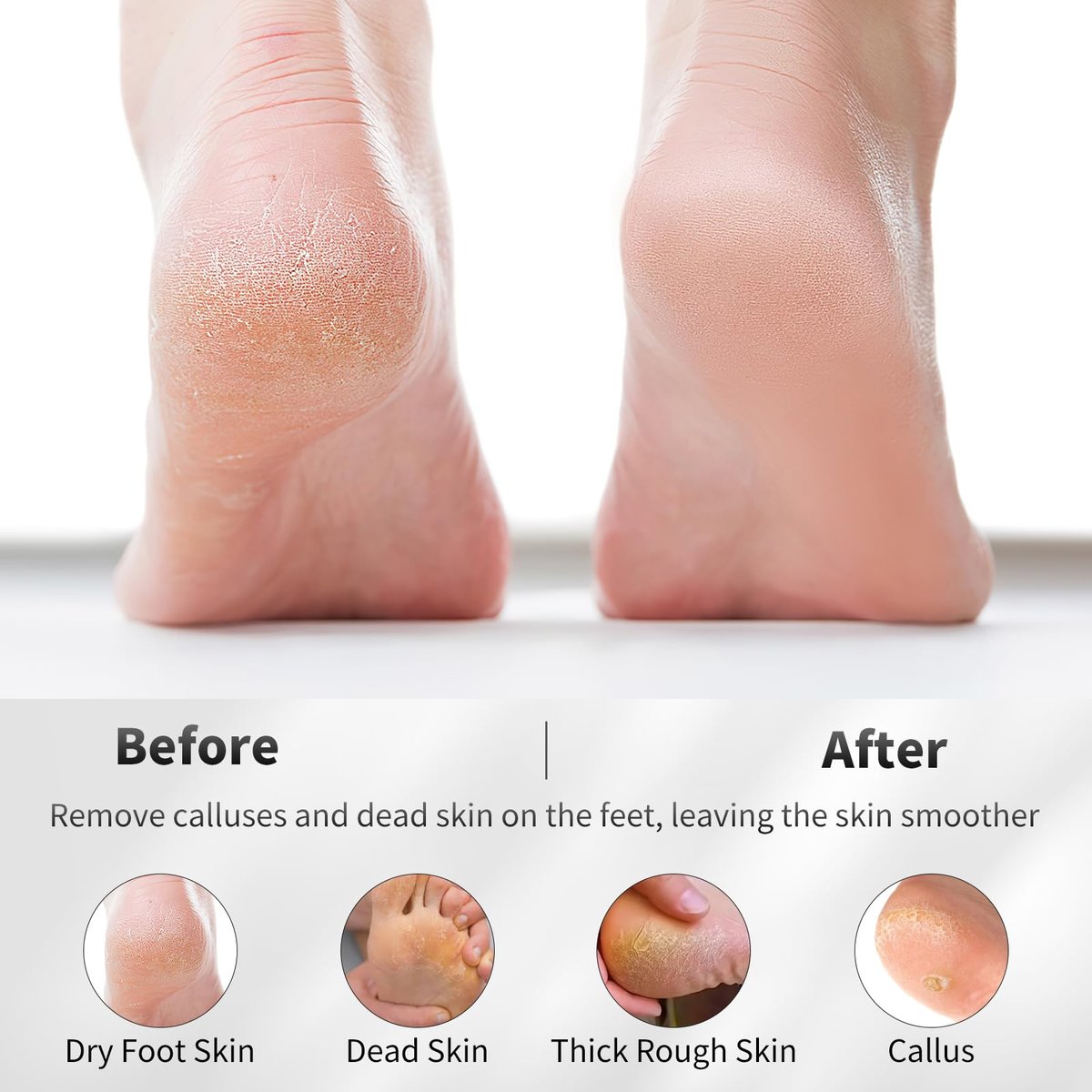 ÖkoStamm 4 Pack Natural Volcanic Pumice Stone for Feet – Rough Feet Scrubber with Hanging Rope for Dead Skin Removal, Pedicure Exfoliation Tool for Feet, Elbows, Knees - görsel 7
