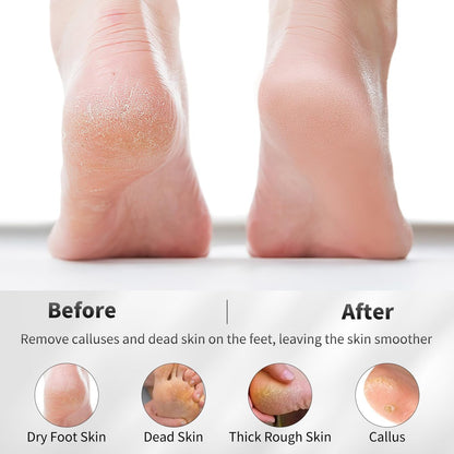 ÖkoStamm 4 Pack Natural Volcanic Pumice Stone for Feet – Rough Feet Scrubber with Hanging Rope for Dead Skin Removal, Pedicure Exfoliation Tool for Feet, Elbows, Knees