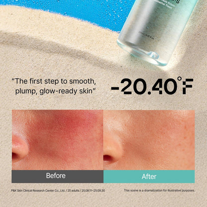 Overlaps 5000ppm Ectoin Calming Toner | Redness Relief & Barrier Repair for Sensitive & Blemish-Prone Skin | Glass Skin Hydration with Hyaluronic Acid & Panthenol | Korean Skincare, 8.45 fl. oz. Avelisse