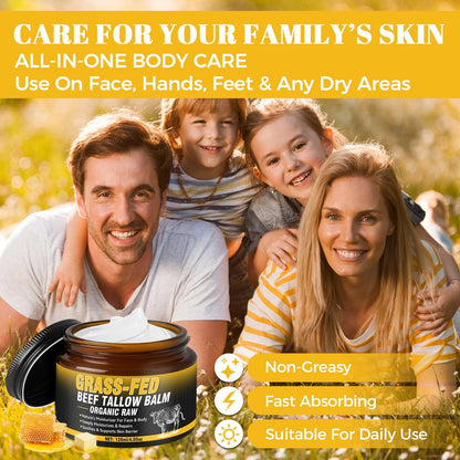 Wonshine Beef Tallow for Skin Cream – Grass-Fed Whipped Tallow & Honey Balm, Deep Nourishing Face Moisturizer 4.05 oz Avelisse