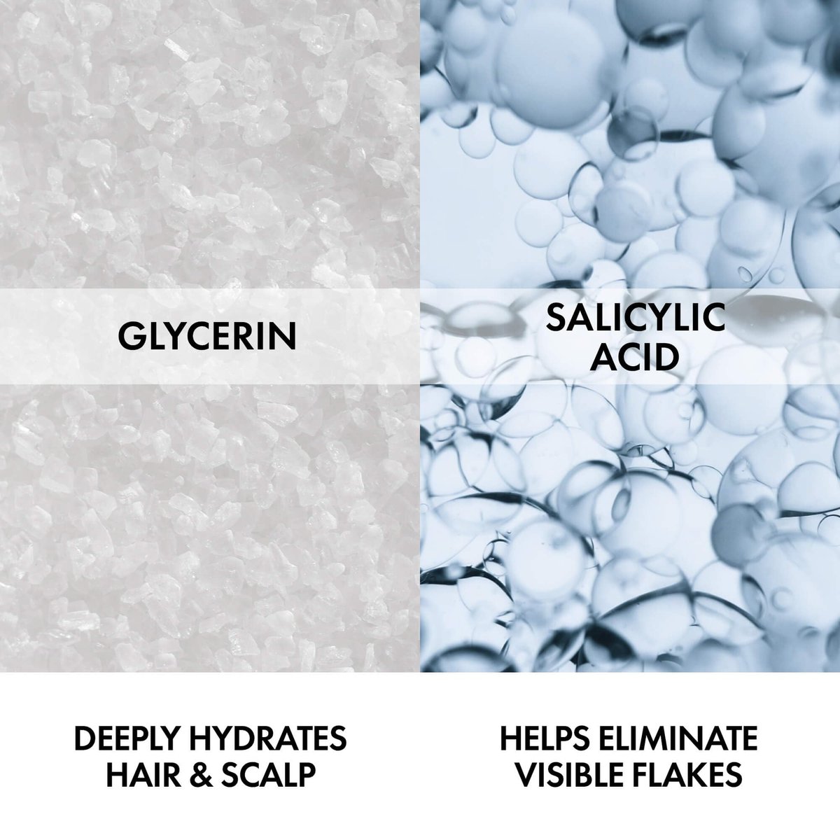 VICHY Dercos Anti-Dandruff Shampoo with Salicylic Acid – Water to Foam Formula for Itchy Scalp & Curly Hair – Sulfate Free, Frizz Control, 6.76 Fl Oz Avelisse