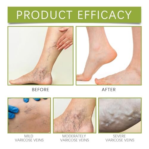 Senzion Official Balm 2 Pack - Natural Ingredients for Legs, Arms, Back | Senzion Miracle Balm - görsel 12