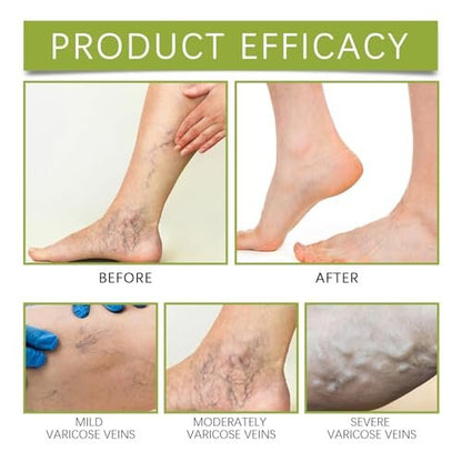 Senzion Official Balm 2 Pack - Natural Ingredients for Legs, Arms, Back | Senzion Miracle Balm