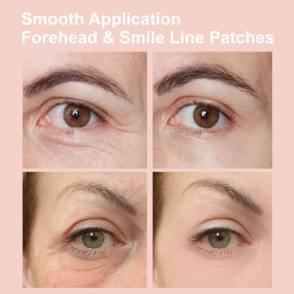 NOVALIFT Kunnozz Micro Eye Patches – Under Eye Patches for Puffy Eyes & Dark Circles, Smile Line & Forehead Hydrating Anti-Wrinkle Masks (2 Boxes, 3 Pairs Each) Avelisse