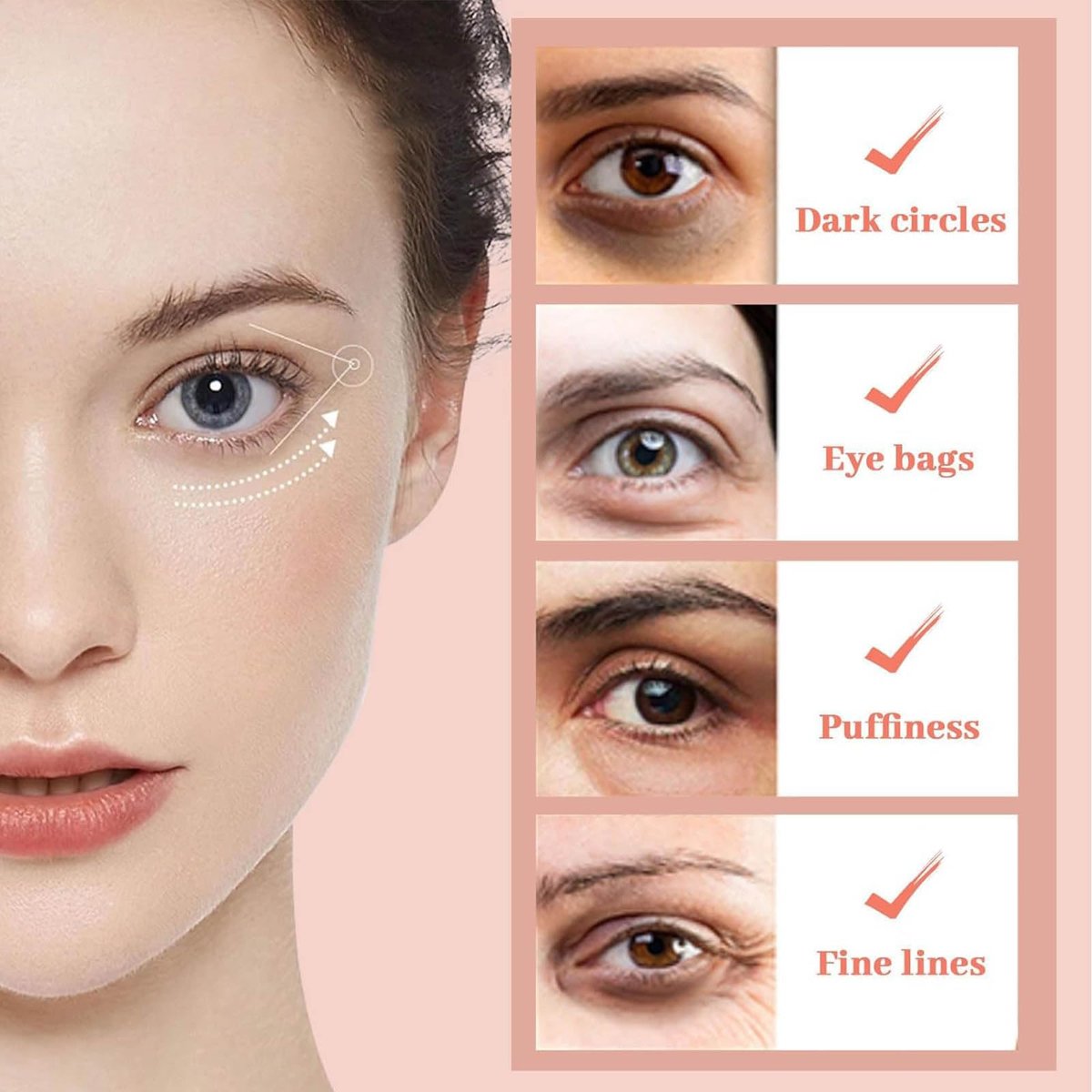 NOVALIFT Kunnozz Micro Eye Patches – Under Eye Patches for Puffy Eyes & Dark Circles, Smile Line & Forehead Hydrating Anti-Wrinkle Masks (2 Boxes, 3 Pairs Each) Avelisse