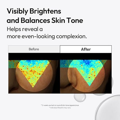 LAYERLAB Niacinamide 7% & Tranexamic Acid 3% Dark Spot Appearance Serum | 13% Radiance Complex Visibly Evens Skin Tone Look | Hydrating K-Beauty Skincare 0.94 fl.oz Avelisse
