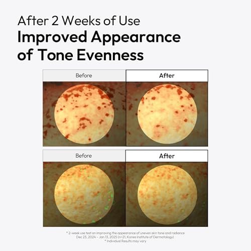 LAYERLAB Niacinamide 7% & Tranexamic Acid 3% Dark Spot Appearance Serum | 13% Radiance Complex Visibly Evens Skin Tone Look | Hydrating K-Beauty Skincare 0.94 fl.oz Avelisse