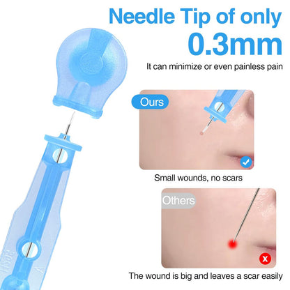 MixS Live Sterile Pimple Needle Kit - 80 Ultra-Fine Acne Needles + 108 Acne Pimple Stickers for Blackhead and Blemish Removal - Clear Skin Solution
