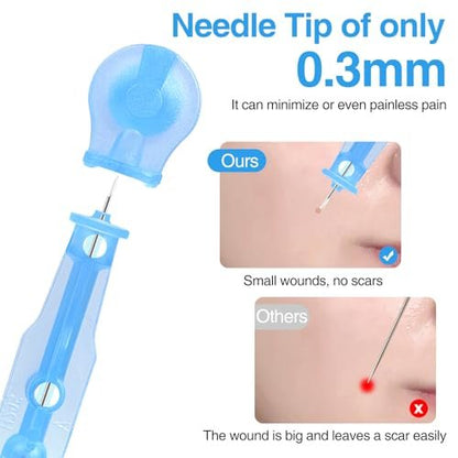 MixS Live Sterile Pimple Needle Kit - 80 Ultra-Fine Acne Needles + 108 Acne Pimple Stickers for Blackhead and Blemish Removal - Clear Skin Solution