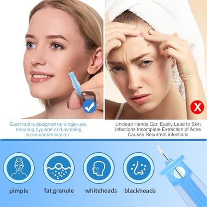 MixS Live Sterile Pimple Needle Kit - 80 Ultra-Fine Acne Needles + 108 Acne Pimple Stickers for Blackhead and Blemish Removal - Clear Skin Solution